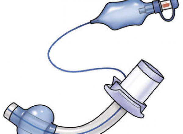Tracheostomy tube